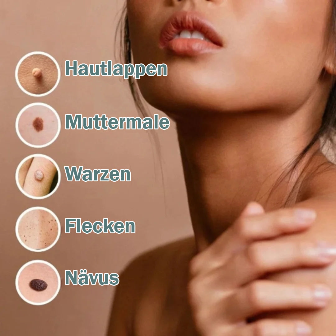 Hautwucherung Entferner Pen – Schnell und Effektiv – Für Gesicht und Körper