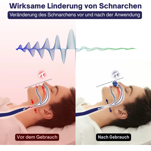 Slaapapneu-masker – Anti-snurkapparaat – Compact en draagbaar – Voor een betere nachtrust