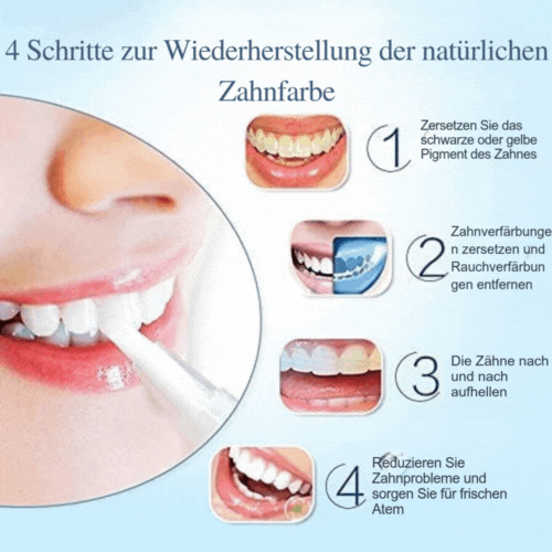 Zahnaufhellungsstift – Einfach zu verwenden – Für weißere Zähne – Gegen Flecken